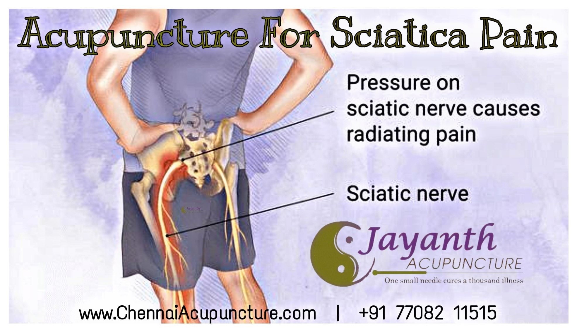 Image - Chennai Jayanth Acupuncture Clinic